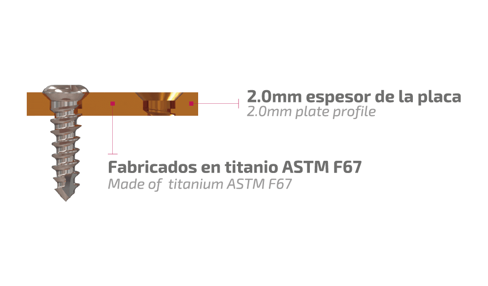 Característica del Sistema Maxibucco 2.4