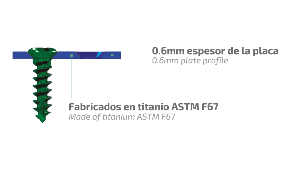 Características del Sistema Maxibucco 1.5