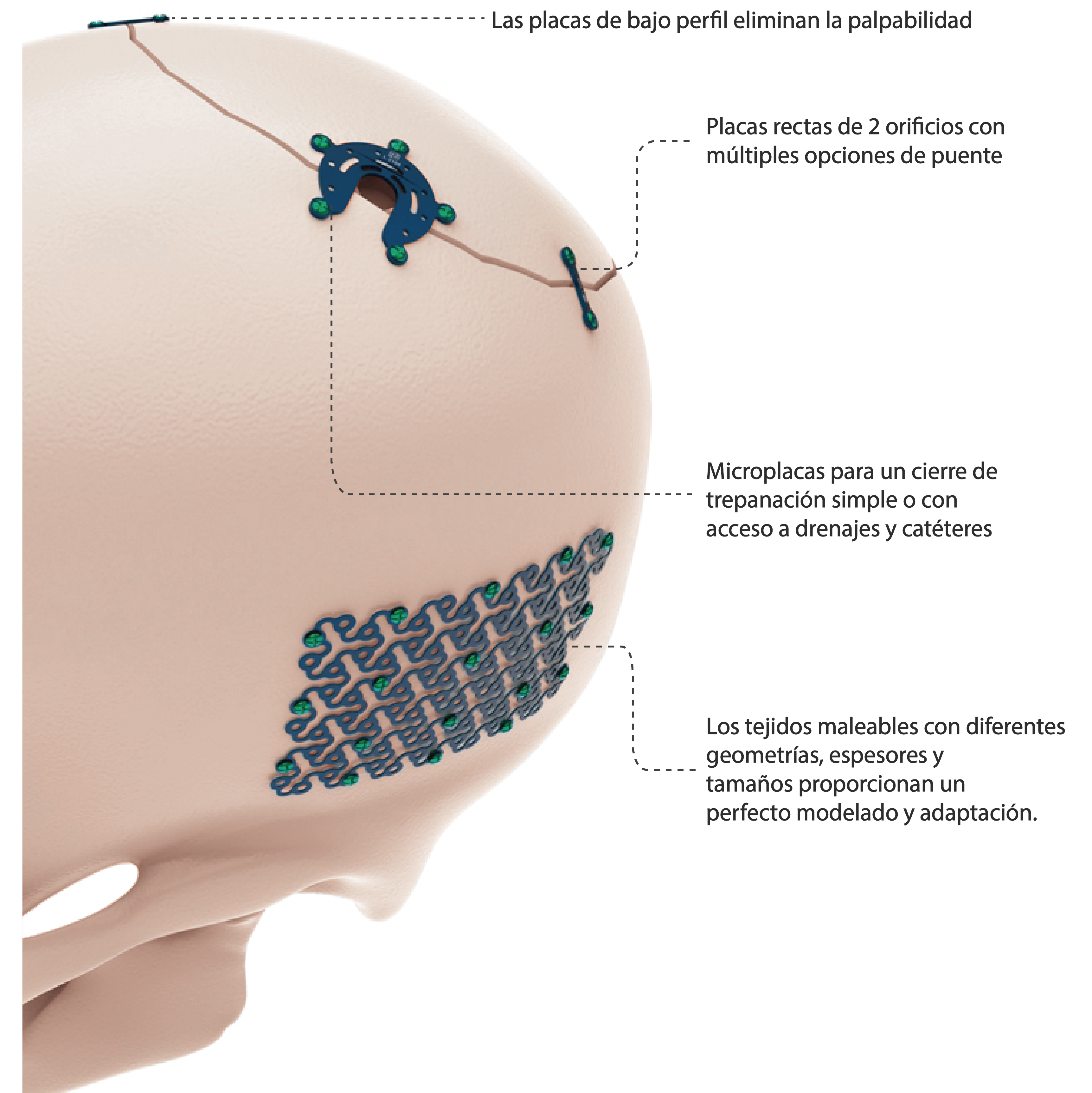 SISTEMA CRANIOMAXILOFACIAL-14