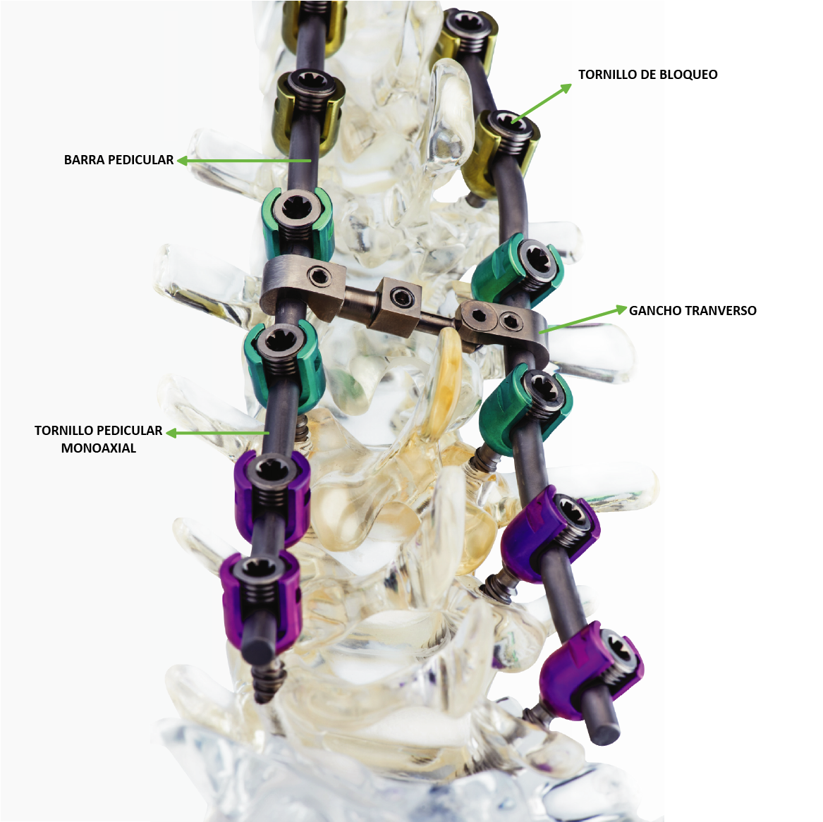 RIGID SPINE PLUS - MONTAJE DO SISTEMA RIGID SPINE